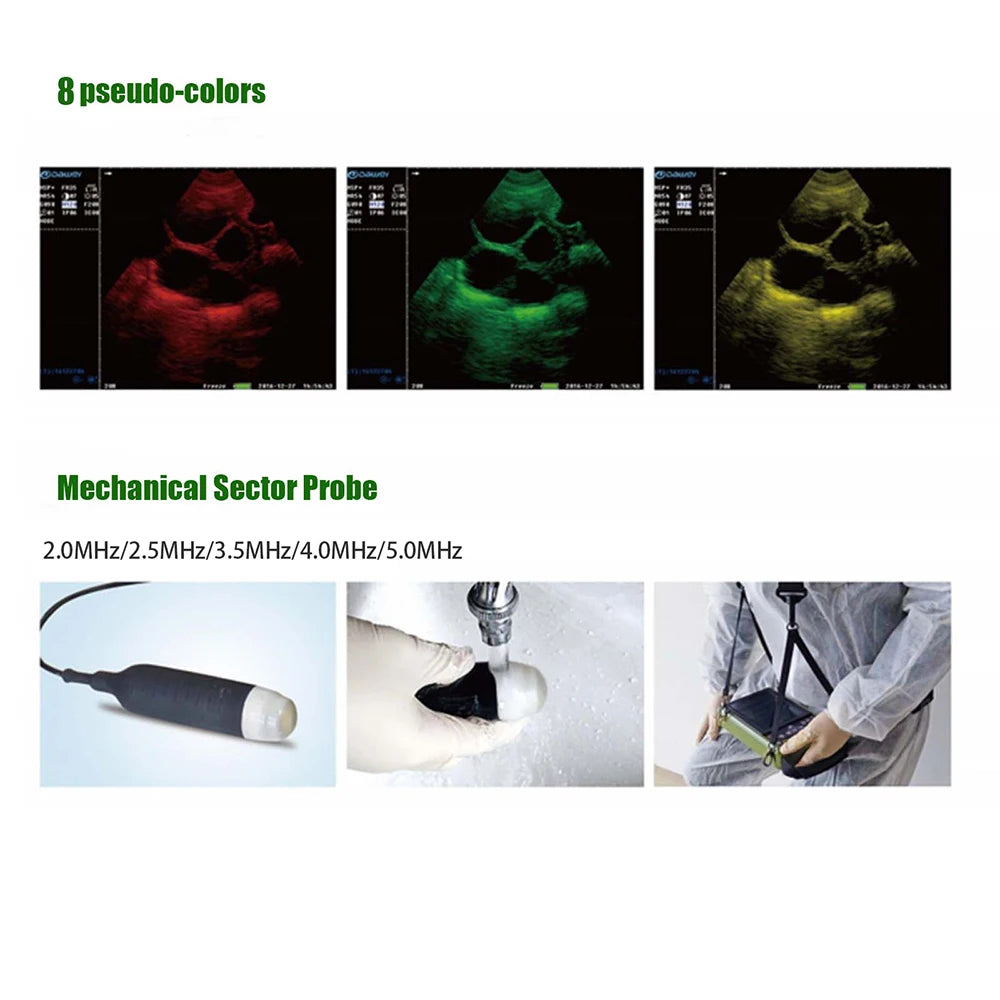 Portable Veterinary Ultrasound Scanner with 3.5MHz Probe